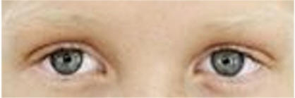 eyes