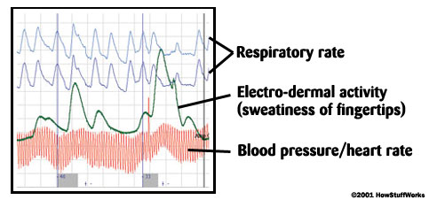 Polygraph Test Results Image 1